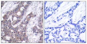Op18 (phospho Ser16) rabbit pAb Antibody