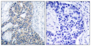Op18 (phospho Ser38) rabbit pAb Antibody