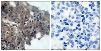 p21 (phospho Thr145) rabbit pAb Antibody