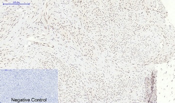 p38 (phospho Thr180) rabbit pAb Antibody