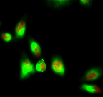 p70 S6 kinase α (phospho Thr229) rabbit pAb Antibody