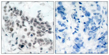 Rb (phospho Ser780) rabbit pAb Antibody