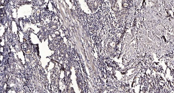 Shb (phospho Tyr246) rabbit pAb Antibody