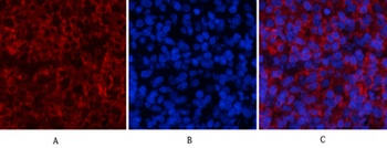 Stat1 (phospho Tyr701) rabbit pAb Antibody