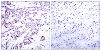 Stat6 (phospho Thr645) rabbit pAb Antibody