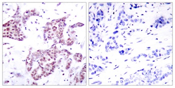 Stat6 (phospho Tyr641) rabbit pAb Antibody