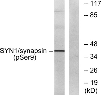 Synapsin I (phospho Ser9) rabbit pAb Antibody