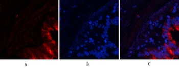 Tau (phospho Ser396) rabbit pAb Antibody