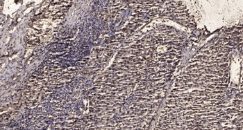 GSK3β (phospho Ser9) rabbit pAb Antibody