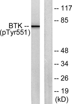 Btk (phospho Tyr551) rabbit pAb Antibody