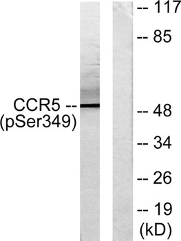 CKR-5 (phospho Ser349) rabbit pAb Antibody