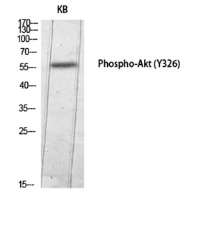 Akt (phospho Tyr326) rabbit pAb Antibody
