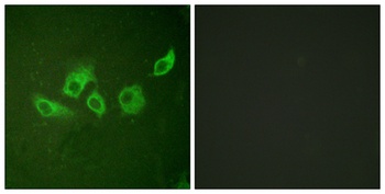 Crk II (phospho Tyr221) rabbit pAb Antibody