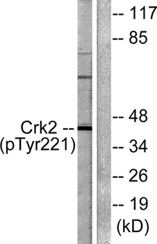 Crk II (phospho Tyr221) rabbit pAb Antibody