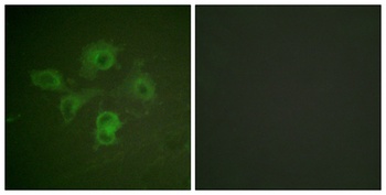 EphB1/2 (phospho Tyr594/604) rabbit pAb Antibody