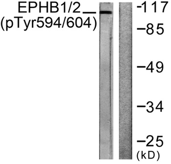 EphB1/2 (phospho Tyr594/604) rabbit pAb Antibody
