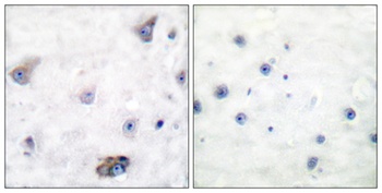 GABAA Rβ1 (phospho Ser434) rabbit pAb Antibody