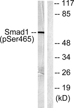 Smad1 (phospho Ser465) rabbit pAb Antibody