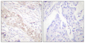 Smad2 (phospho Ser467) rabbit pAb Antibody