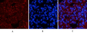 Smad3 (phospho Ser425) rabbit pAb Antibody