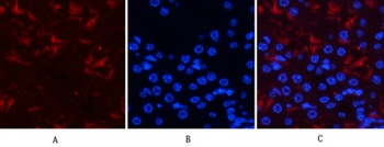 Smad3 (phospho Ser425) rabbit pAb Antibody