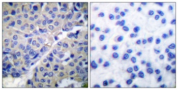 Synaptotagmin 1/2 (phospho Ser309/306) rabbit pAb Antibody