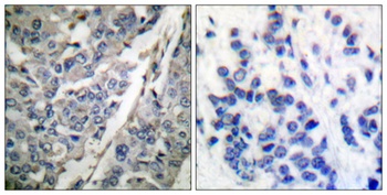 Synaptotagmin 1/2 (phospho Thr202/199) rabbit pAb Antibody