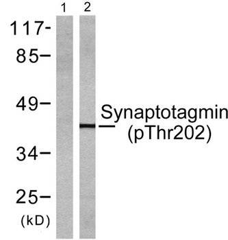 Synaptotagmin 1/2 (phospho Thr202/199) rabbit pAb Antibody