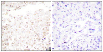 Cdk2/Cdc2 (phospho Thr160) rabbit pAb Antibody
