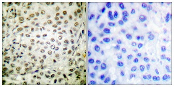Cdk2/Cdc2 (phospho Thr160) rabbit pAb Antibody