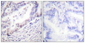 Cdk2/Cdc2 (phospho Thr160) rabbit pAb Antibody