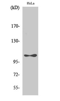 eEF2K (phospho Ser366) rabbit pAb Antibody