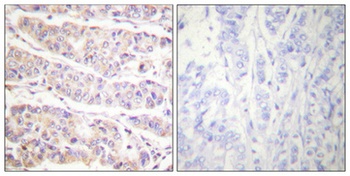 Filamin 1 (phospho Ser2152) rabbit pAb Antibody