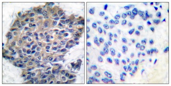 Filamin 1 (phospho Ser2152) rabbit pAb Antibody