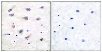 PLC β3 (phospho Ser1105) rabbit pAb Antibody