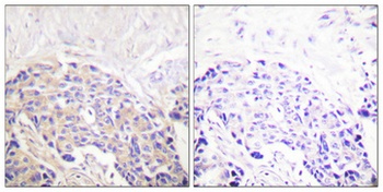 PLC γ1 (phospho Tyr771) rabbit pAb Antibody