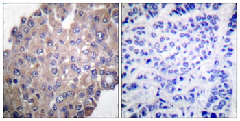 PLC γ1 (phospho Tyr771) rabbit pAb Antibody