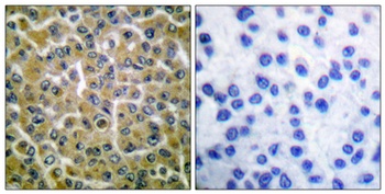 PLC γ2 (phospho Tyr753) rabbit pAb Antibody