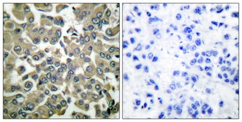 WNK1 (phospho Thr60) rabbit pAb Antibody