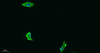 Flt-1 (phospho Tyr1333) rabbit pAb Antibody