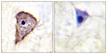 Flt-1 (phospho Tyr1333) rabbit pAb Antibody