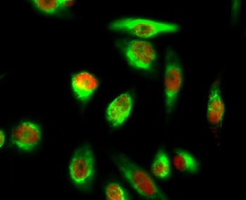 YAP (phospho Ser127) rabbit pAb Antibody