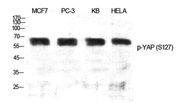 YAP (phospho Ser127) rabbit pAb Antibody