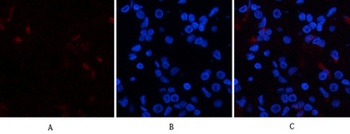 p38 (phospho Tyr323) rabbit pAb Antibody