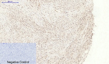 p38 (phospho Tyr323) rabbit pAb Antibody