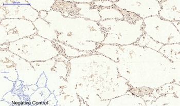 p38 (phospho Tyr323) rabbit pAb Antibody