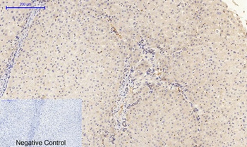 FAK (phospho Tyr397) rabbit pAb Antibody