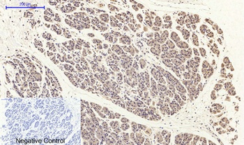 FAK (phospho Tyr397) rabbit pAb Antibody