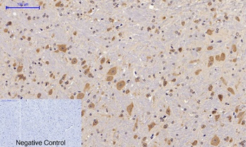 FAK (phospho Tyr397) rabbit pAb Antibody