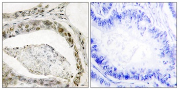 Smad3 (phospho Ser208) rabbit pAb Antibody